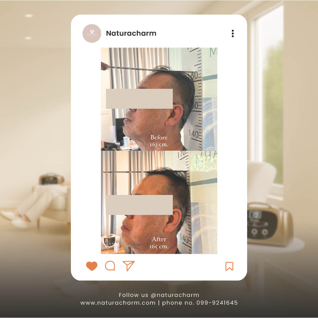 จัดกระดูก